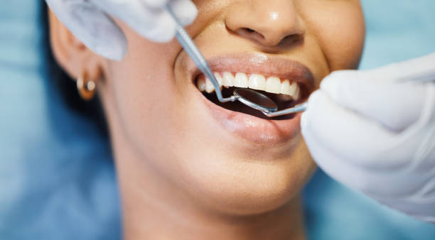 Best Teeth Whitening  in Cajahs Mountain, NC